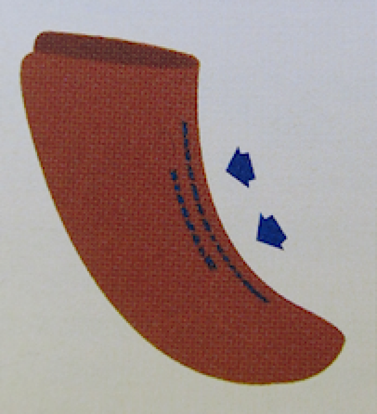 SAGITTA
